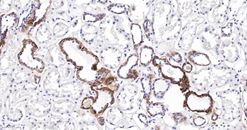 CLDN7 Mouse mAb
