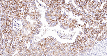 CLDN7 Mouse mAb