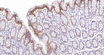 CLDN7 Mouse mAb