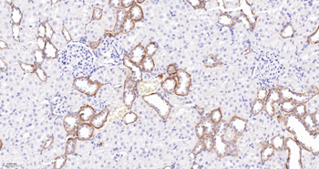 CLDN7 Mouse mAb