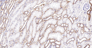 CLDN7 Mouse mAb