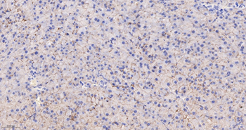 CLDN7 Mouse mAb