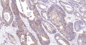 CLDN7 Mouse mAb