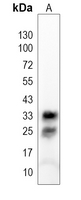 SULT1A1 Rabbit Polyclonal Antibody