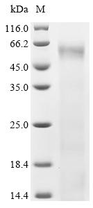 Human EIF2AK2 protein