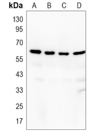 CNDP1 Rabbit Polyclonal Antibody