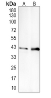 CD152 Rabbit Polyclonal Antibody