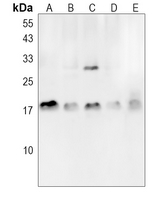 FGFBP1 Rabbit Polyclonal Antibody