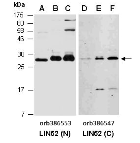 LIN52 (N) Antibody, Rabbit Polyclonal