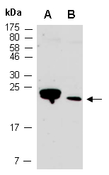 BEX1 (N2) Antibody, Rabbit Polyclonal