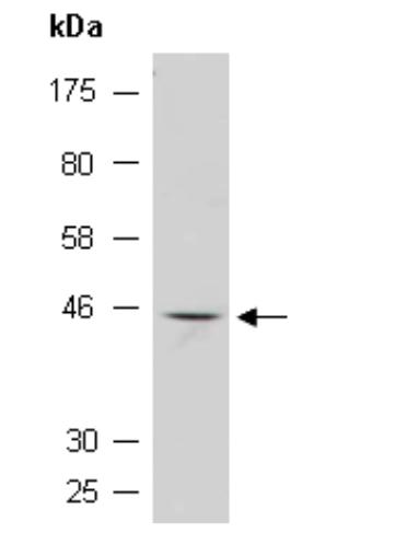 WT1 (C) Antibody, Rabbit Polyclonal
