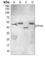 ABHD7 Rabbit Polyclonal Antibody