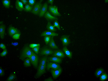 NQO2 Antibody