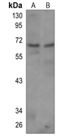 ACBD5 Rabbit Polyclonal Antibody