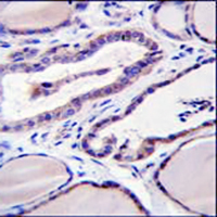 GUCY2D Rabbit Polyclonal Antibody