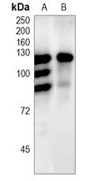 ChREBP Rabbit Polyclonal Antibody