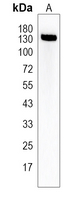 PALB2 Rabbit Polyclonal Antibody