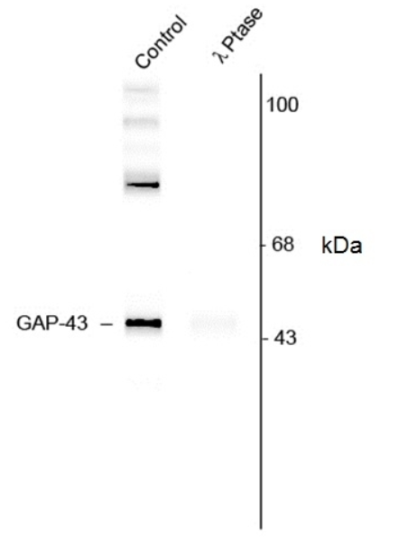 RABBIT ANTI GAP43 (pSer41)
