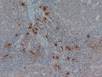 MAST CELL TRYPTASE Antibody