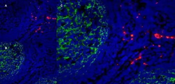 CD163 Mouse Monoclonal Antibody (EDHu-1)
