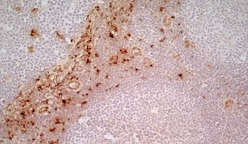CD163 Mouse Monoclonal Antibody (EDHu-1)