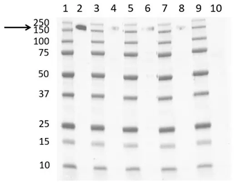 CD163 Mouse Monoclonal Antibody (EDHu-1)