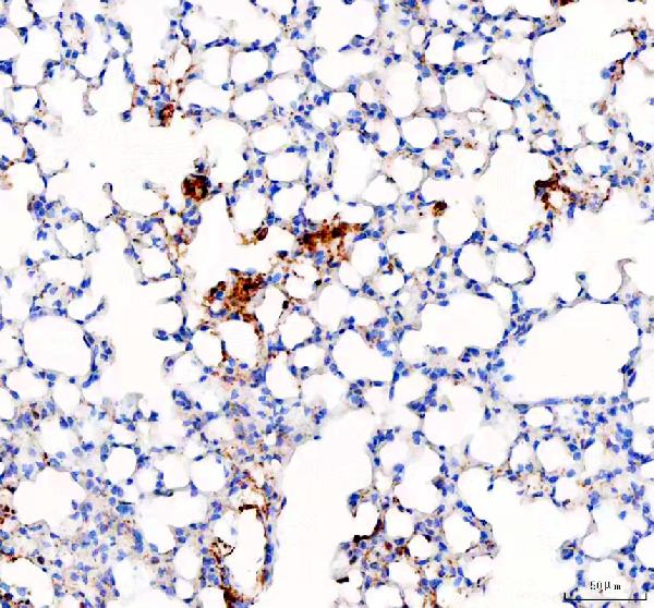 SLC34A2 Antibody