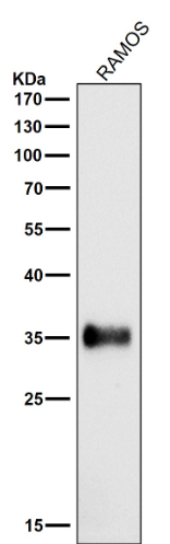Anti-HLA-DRA/Hla Dr Rabbit Monoclonal Antibody