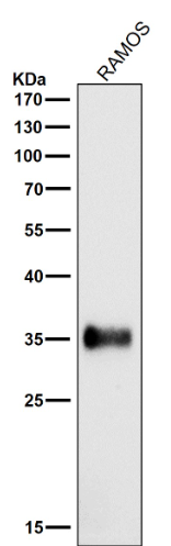 HLA-DRA/Hla Dr Rabbit Monoclonal Antibody