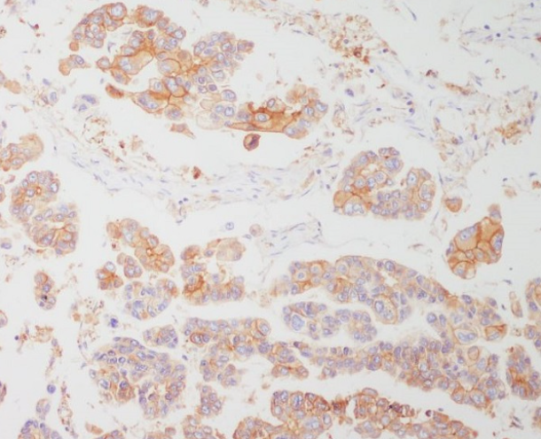 Anti-HLA-DRA/Hla Dr Rabbit Monoclonal Antibody