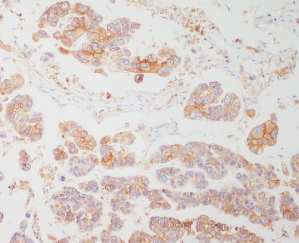 HLA-DRA/Hla Dr Rabbit Monoclonal Antibody