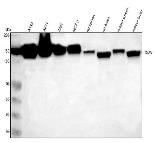 Anti-Integrin alpha V ITGAV Rabbit Monoclonal Antibody