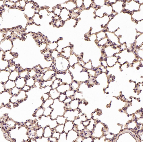 Anti-Integrin alpha V ITGAV Rabbit Monoclonal Antibody