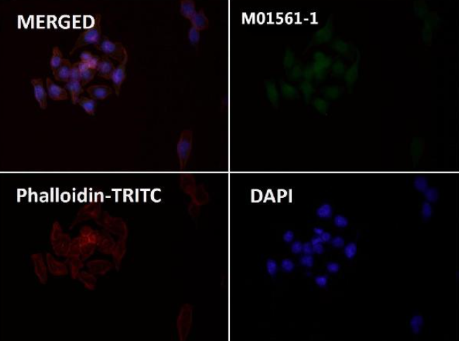 Anti-Integrin alpha V ITGAV Rabbit Monoclonal Antibody