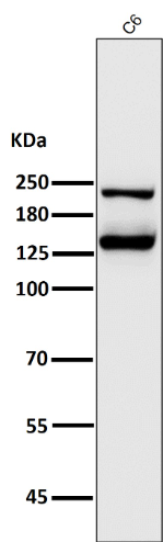 Anti-Integrin alpha V ITGAV Rabbit Monoclonal Antibody