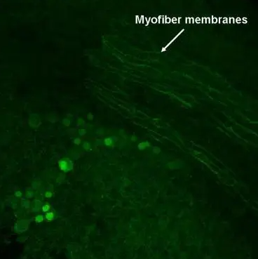 GAD67 antibody