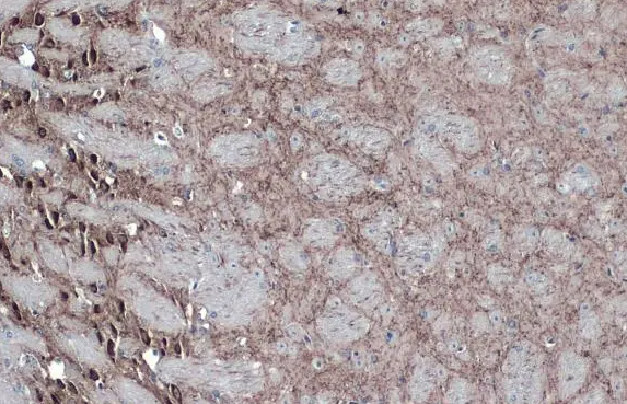 GAD67 antibody