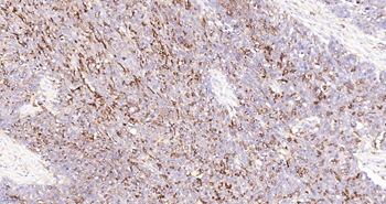 CD163 Recombinant Rabbit Monoclonal Antibody