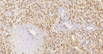 CD163 Recombinant Rabbit Monoclonal Antibody