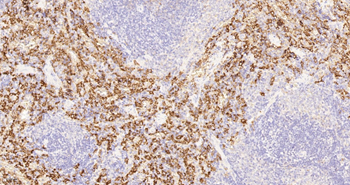 CD163 Recombinant Rabbit Monoclonal Antibody