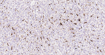 CD163 Recombinant Rabbit Monoclonal Antibody