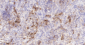 CD163 Recombinant Rabbit Monoclonal Antibody