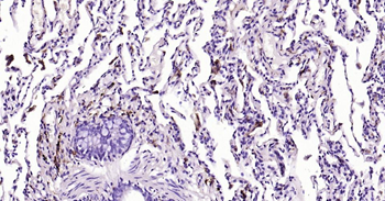 CD163 Recombinant Rabbit Monoclonal Antibody