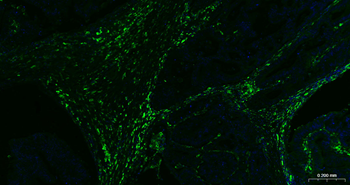 CD163 Recombinant Rabbit Monoclonal Antibody