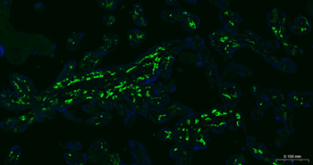 CD163 Recombinant Rabbit Monoclonal Antibody