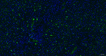 CD163 Recombinant Rabbit Monoclonal Antibody