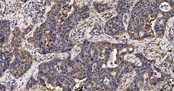 GLUT1 Recombinant Rabbit Monoclonal Antibody