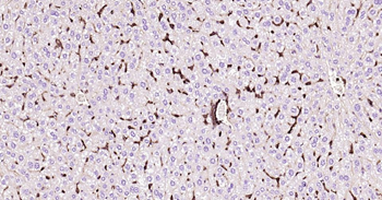 GLUT1 Recombinant Rabbit Monoclonal Antibody