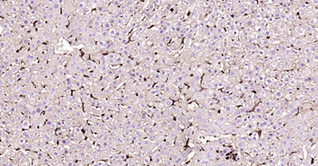 GLUT1 Recombinant Rabbit Monoclonal Antibody