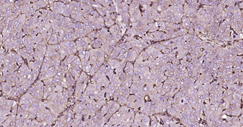 GLUT1 Recombinant Rabbit Monoclonal Antibody